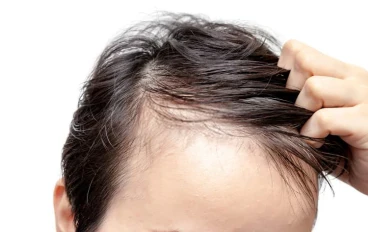 Is dyeing hair forbidden in Islam?