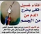صورة مقال الكلي آية من آيات الله في جسد الإنسان 