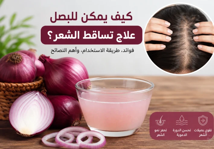 كيف يمكن للبصل أن يقلل فراغات الشعر ؟؟!