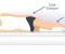 صورة مقال Back Pain Exercises: A Comprehensive Guide to Natural Lower Back Pain Relief