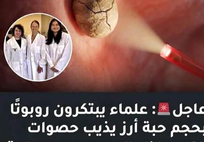 بشرى لمرضى حصوات الكلى: ثورة هادئة قادمة من مختبرات جامعة واترلو