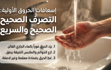 الإسعافات الأولية للحروق ... أخطاء يرتكبها الجميع وقد تزيد الإصابة خطورة 