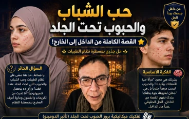 حب الشباب والحبوب تحت الجلد: خطوات العلاج وفق نظام الطيبات