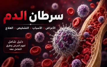 سرطان الدم: الأعراض والأسباب وطرق التشخيص والعلاج الحديثة