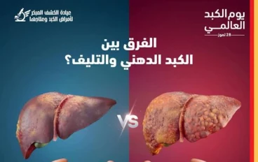 دهون الكبد: العدو الصامت.. كيف تتكون وكيف تستعيد كبدك؟
