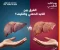 صورة مقال دهون الكبد: العدو الصامت.. كيف تتكون وكيف تستعيد كبدك؟