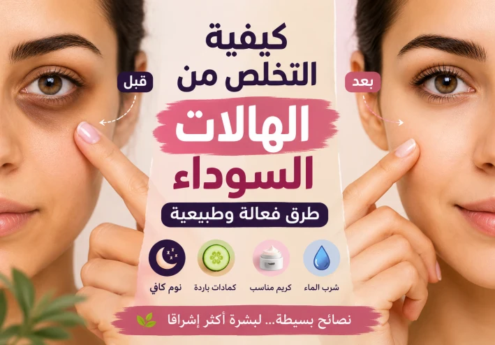 كيفية التخلص من الهالات السوداء تحت العين بطرق فعالة وآمنة