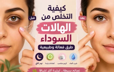 كيفية التخلص من الهالات السوداء تحت العين بطرق فعالة وآمنة
