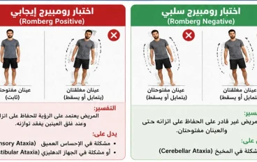 فقدان الاتزان Ataxia 