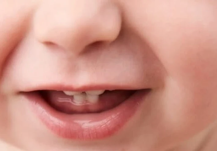 كيف تظهر أسنان طفلك من الرحم إلى الابتسامة؟