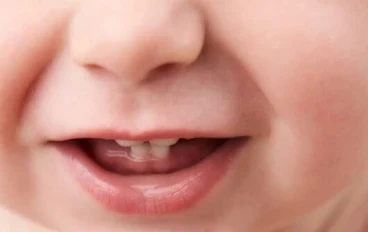 كيف تظهر أسنان طفلك من الرحم إلى الابتسامة؟