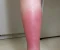 صورة مقال الالتهاب الخلوي تعريفه واعراضه والتشخيص والعلاج Cellulitis 
