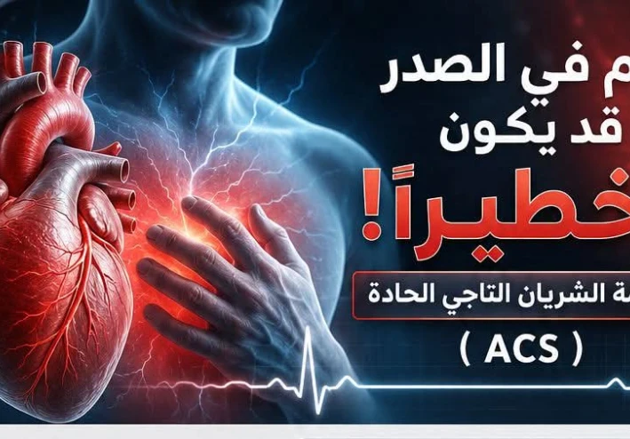 الم الصدر اخطرهم الذبحه الصدريه STEMI