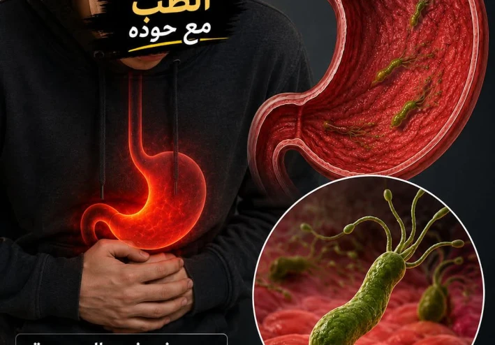 ايه هي جرثومة_المعدة (H.pylori) ؟