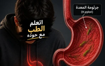  ايه هي جرثومة_المعدة (H.pylori) ؟