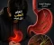 صورة مقال  ايه هي جرثومة_المعدة (H.pylori) ؟