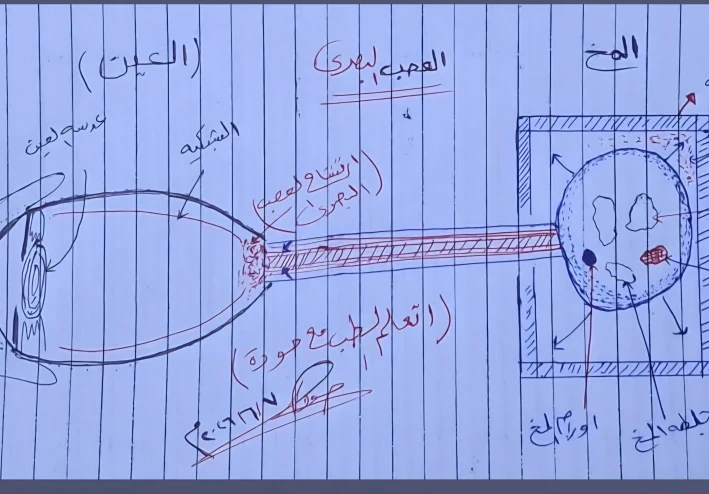 ارتشاح العصب البصري (Papilledema