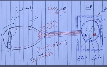 ارتشاح العصب البصري (Papilledema