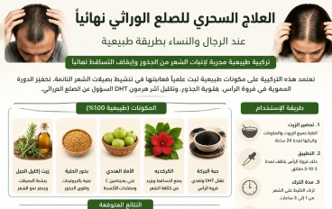 العلاج السحري لمشكلة الصلع الوراثي نهائياً عند الرجال والنساء بطريقة طبيعية وبسيطة وقل وداعاً للصلع