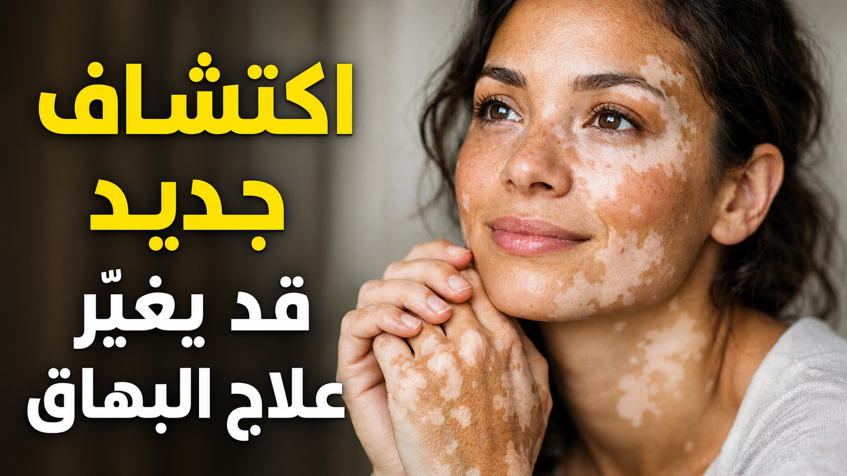 اكتشاف علمي جديد يمنح الأمل لمرضى البهاق.. هل يقترب العلاج؟