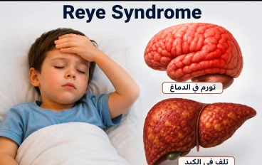 ممنوع إعطاء أي طفل  أقل من 16 سنة دواء يحتوي على الأسبرين من نفسك