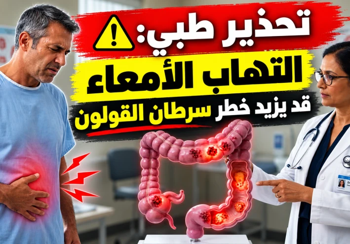 تحذير طبي: التهاب الأمعاء قد يزيد خطر الإصابة بسرطان القولون.. دراسة تكشف الأسباب والأعراض