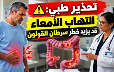 تحذير طبي: التهاب الأمعاء قد يزيد خطر الإصابة بسرطان القولون.. دراسة تكشف الأسباب والأعراض