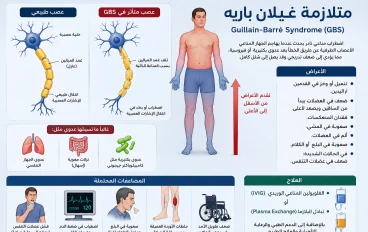 متلازمة غيلان باريه ️  Guillain-Barré Syndrome (GBS)