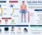 صورة مقال متلازمة غيلان باريه ️  Guillain-Barré Syndrome (GBS)