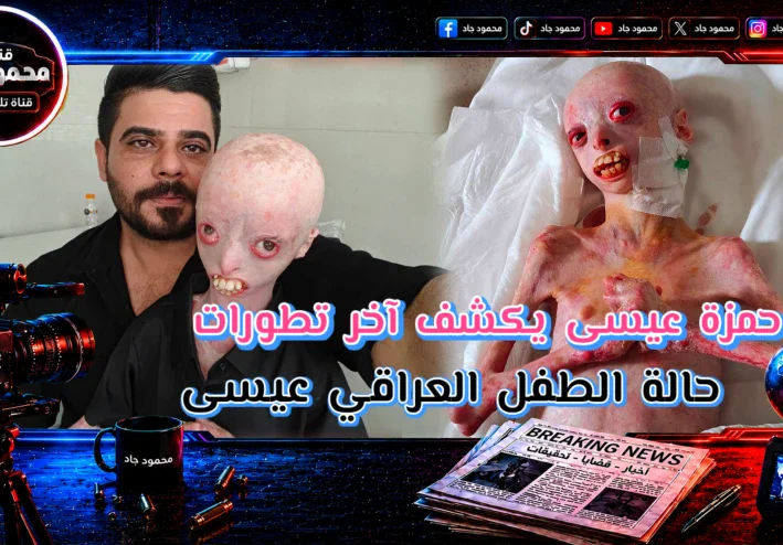 النتائج وصلت من ألمانيا.. ماذا ينتظر الطفل العراقي عيسى بعد أكثر من ثلاث سنوات من المعاناة؟