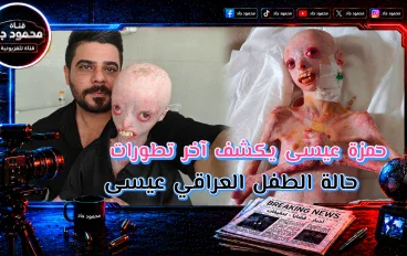النتائج وصلت من ألمانيا.. ماذا ينتظر الطفل العراقي عيسى بعد أكثر من ثلاث سنوات من المعاناة؟