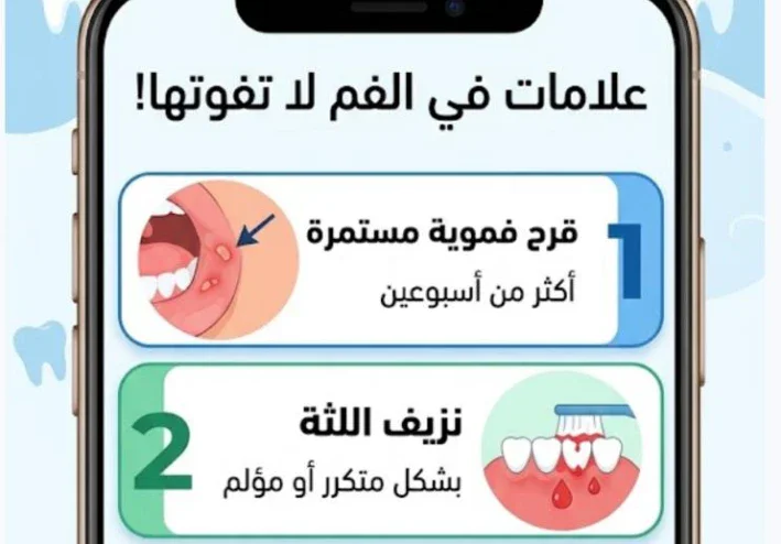 علامات في الفم لا يمكن أن تتجاهلها