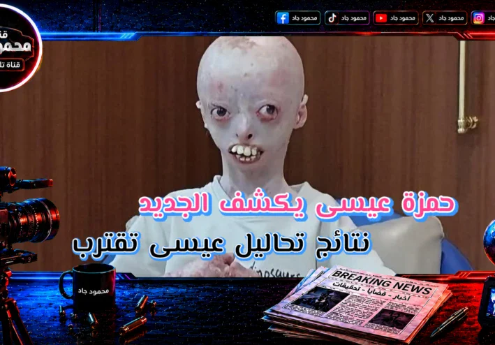 تطورات جديدة في نتائج تحاليل الطفل عيسى واكتشافات الفريق الطبي