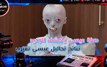 تطورات جديدة في نتائج تحاليل الطفل عيسى واكتشافات الفريق الطبي
