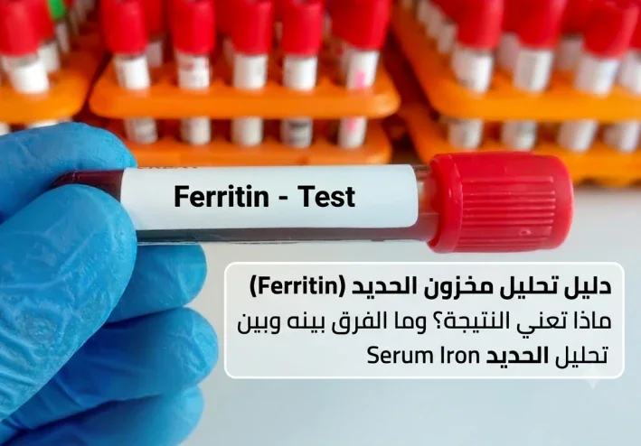 تحليل مخزون الحديد (Ferritin)،ماذا تعني النتيجة؟ وما الفرق بينه و بين تحليل الحديد في الدم (Serum Iron)؟