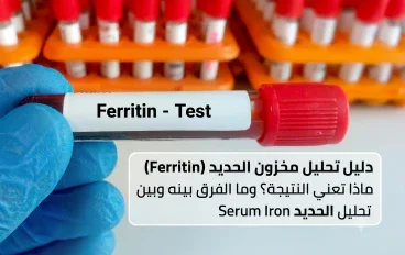 تحليل مخزون الحديد (Ferritin)،ماذا تعني النتيجة؟ وما الفرق بينه و بين تحليل الحديد في الدم (Serum Iron)؟