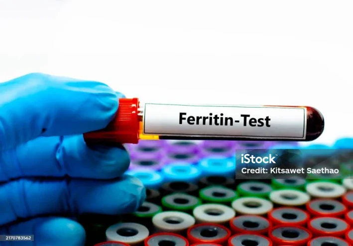 تحليل مخزون الحديد Ferritin: الأعراض والنتائج الطبيعية وأفضل الأطعمة لرفعه