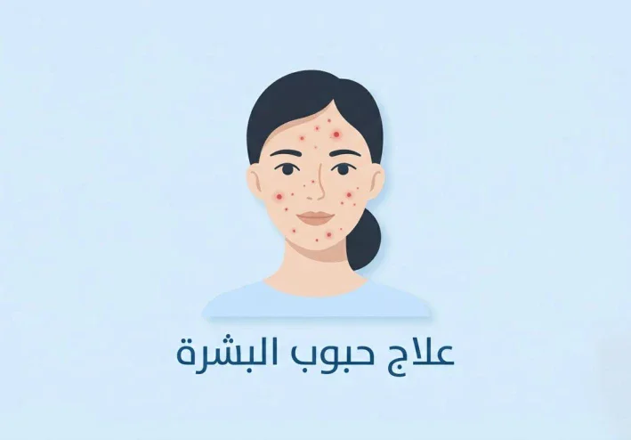 حبوب البشرة: الأسباب والأنواع وطرق العلاج الطبيعي والطبي