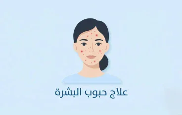 حبوب البشرة: الأسباب والأنواع وطرق العلاج الطبيعي والطبي