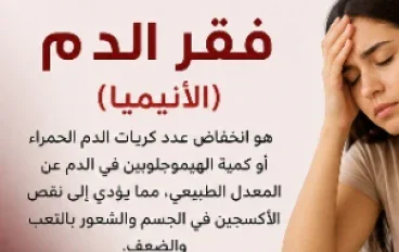 فقر الدم الأنيميا: أسباب خفية وراء التعب والدوخة