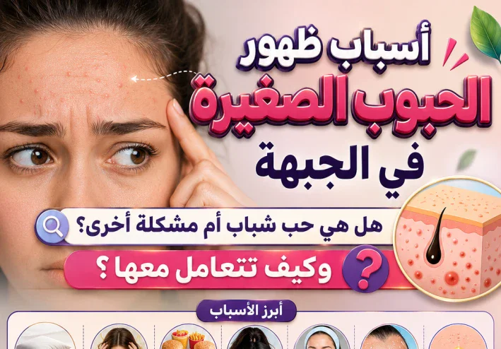 أسباب ظهور الحبوب الصغيرة في الجبهة.. هل هي حب شباب أم مشكلة أخرى؟ وكيف تتعامل معها؟