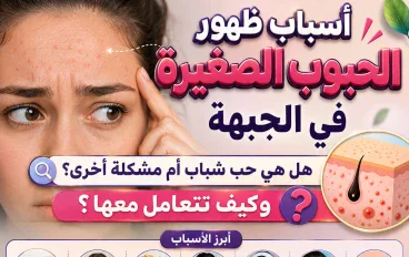 أسباب ظهور الحبوب الصغيرة في الجبهة.. هل هي حب شباب أم مشكلة أخرى؟ وكيف تتعامل معها؟