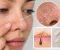 صورة مقال Why Is the Skin Around Your Nose Flaky? The Real Reasons Behind Those Stubborn Dry Patches