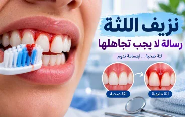 نزيف اللثة عند التنظيف: ماذا يعني تكراره، وكيف تُشخَّص أمراض اللثة وتُعالَج؟
