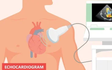 Shortness of Breath and Heart Disease: When Should You Be Concerned?