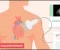 Shortness of Breath and Heart Disease: When Should You Be Concerned?