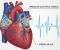 Rapid Heartbeat: Causes, Symptoms, and When to See a Doctor