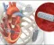 Can Heart Deterioration Be Halted Before Reaching a Critical Stage? What Modern Treatments Say