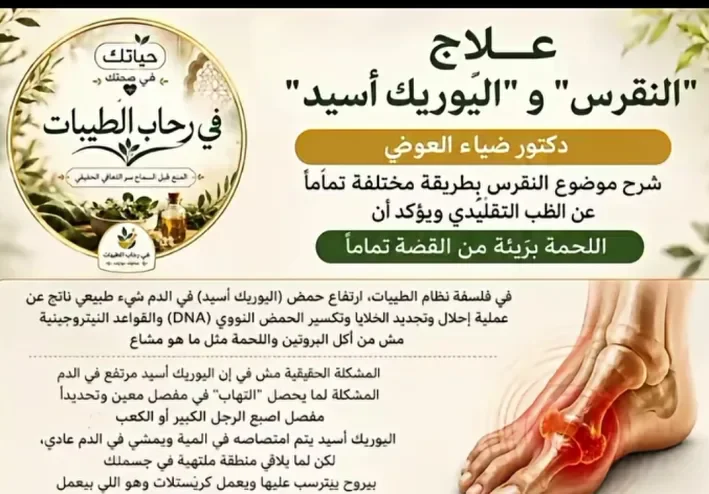 مرض النقرس  وكيفية العلاج والوقايه منه