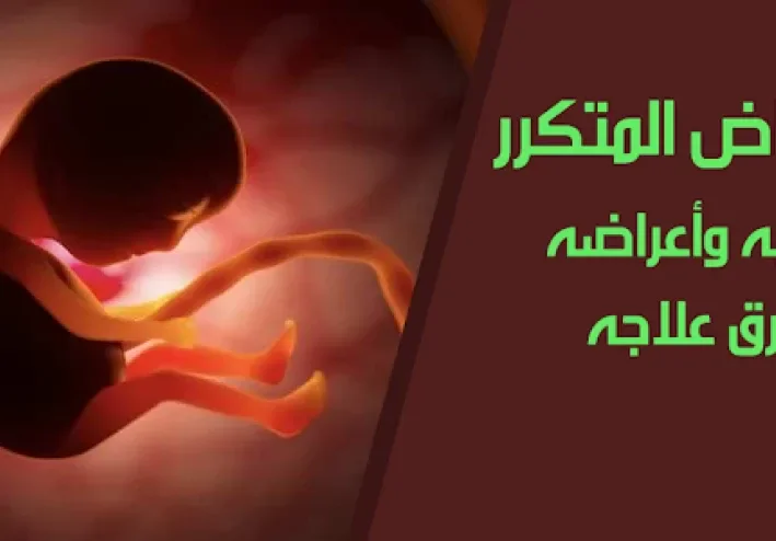 الإجهاض المتكرر: التعريف والأسباب والأعراض وطرق العلاج الطبي